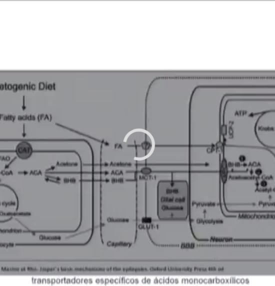 Dieta Cetogénica en Epilepsia.