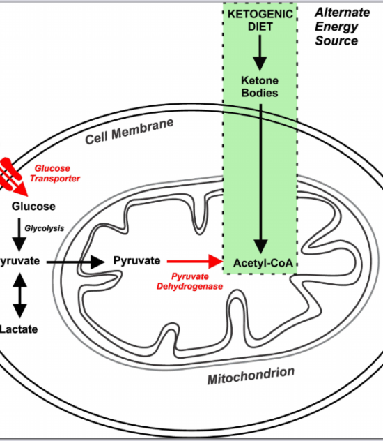 Epilepsias causadas por  enfermedades neurometabólicas, candidatas a recibir terapias cetogénicas.