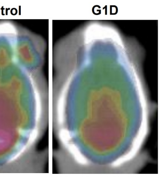 Científicos de la UTSW identifican el circuito cerebral que desencadena una rara epilepsia dependiente del azúcar en sangre.